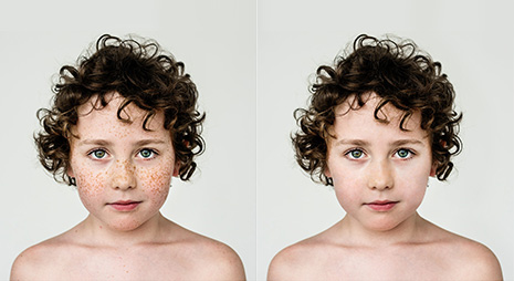 Photo Retouching Service to remove spot from face